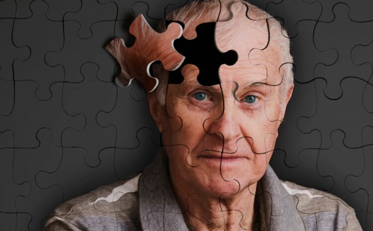  Fármaco experimental parece retrasar la progresión de la enfermedad de Alzheimer en un ensayo clínico, pero plantea problemas de seguridad