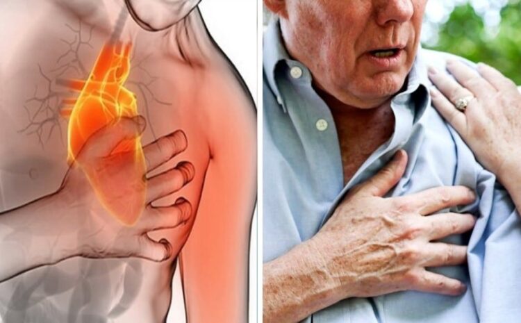  Estos son los síntomas que alertan del infarto de miocardio: hazles caso 